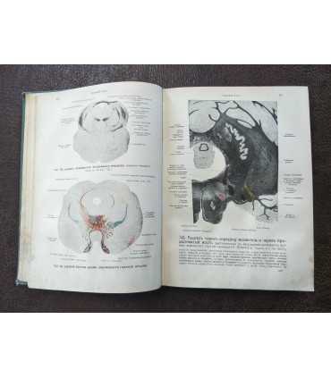 Атлас по анатомии человека - составил Вернер Шпальтегольц