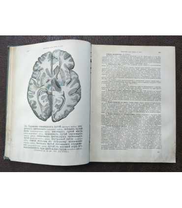 Атлас по анатомии человека - составил Вернер Шпальтегольц