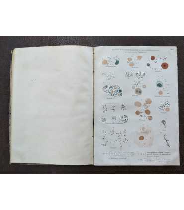 Чума (Pestis bubonica)